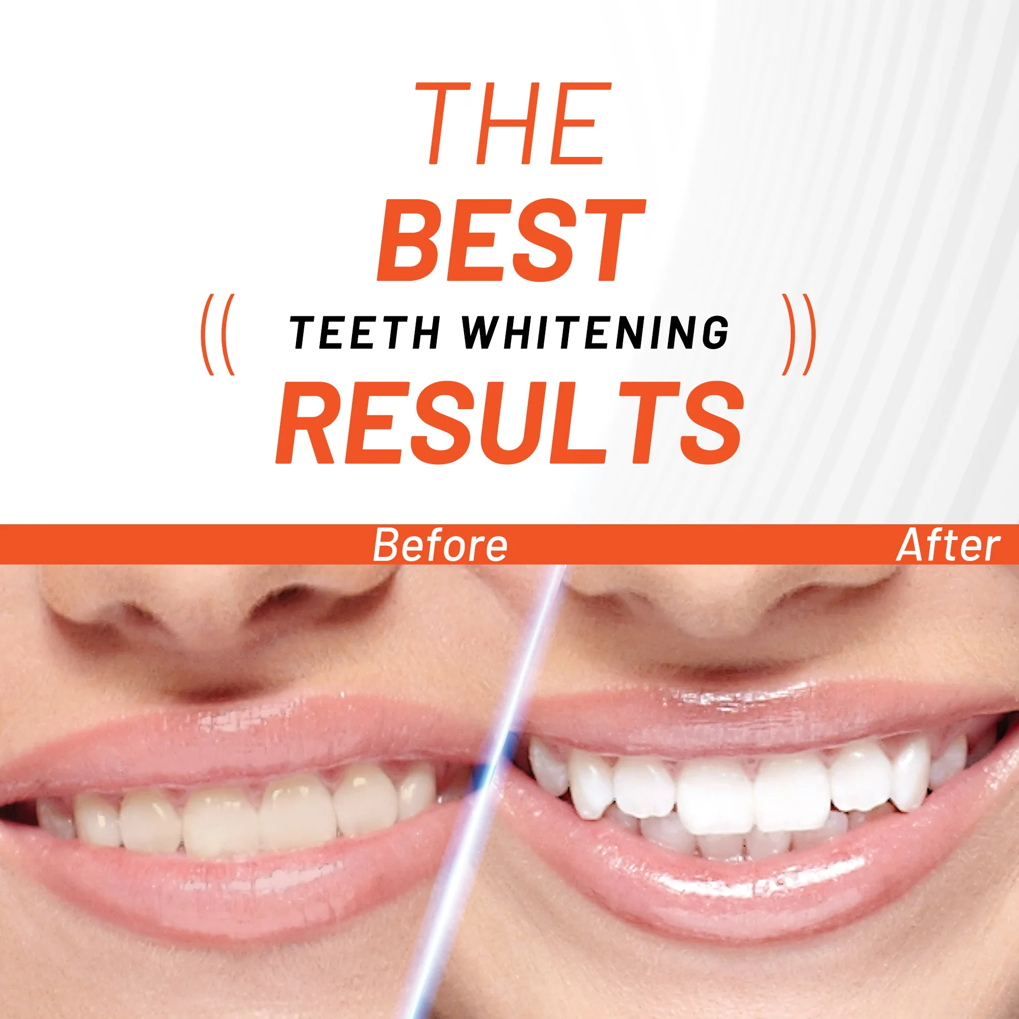Activated Charcoal Teeth Whitening Powder - Image 6
