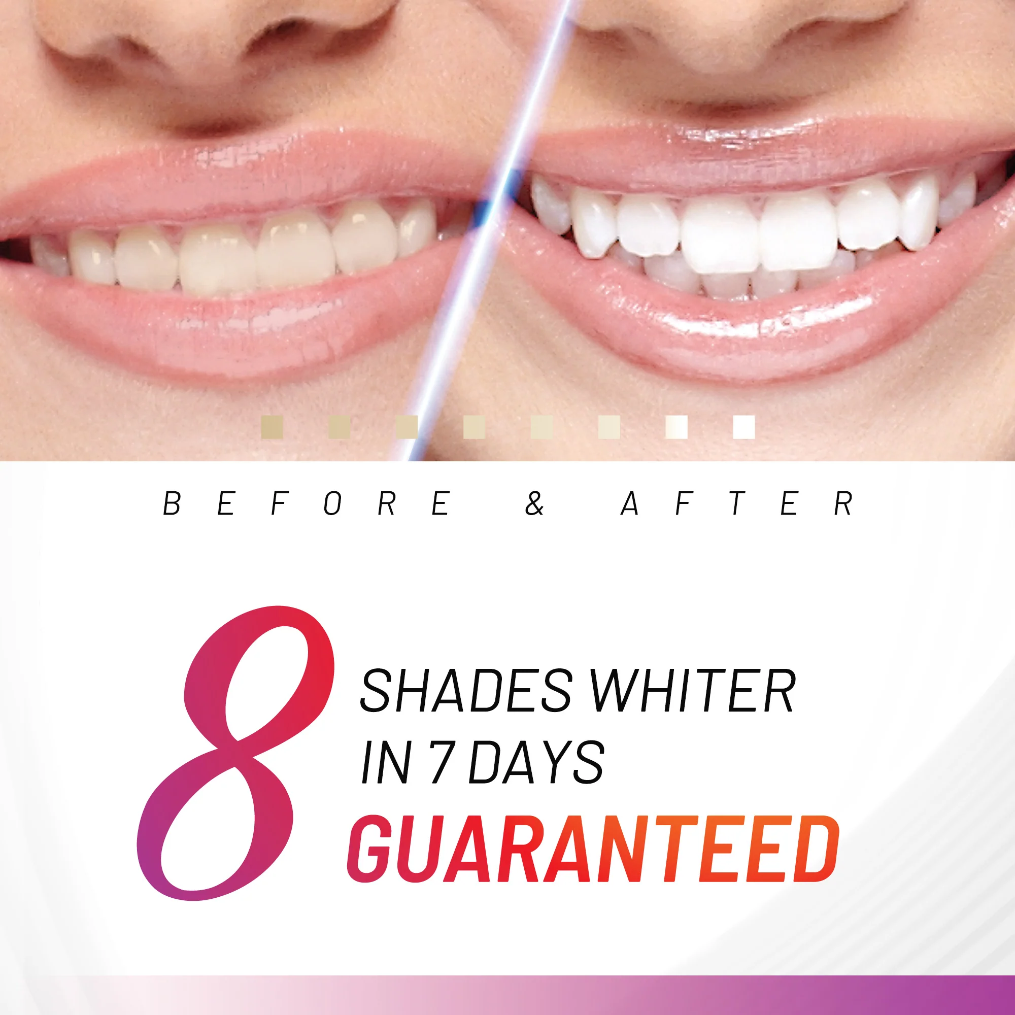 Accelerator Teeth Whitening Kit - Image 3